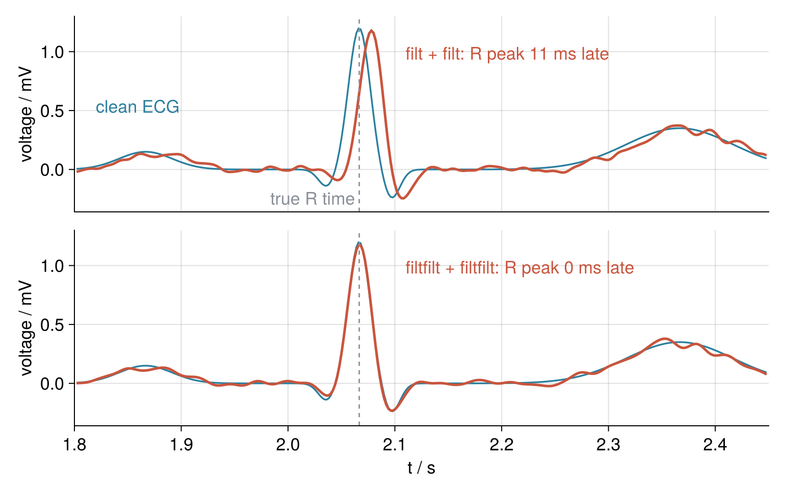 One heartbeat, voltage in mV against time in s; blue is the clean ECG and red the filtered record. Top: the causal filt chain puts the R peak 11 ms after the dashed true R time. Bottom: the filtfilt chain lies on the clean trace, 0 ms late.