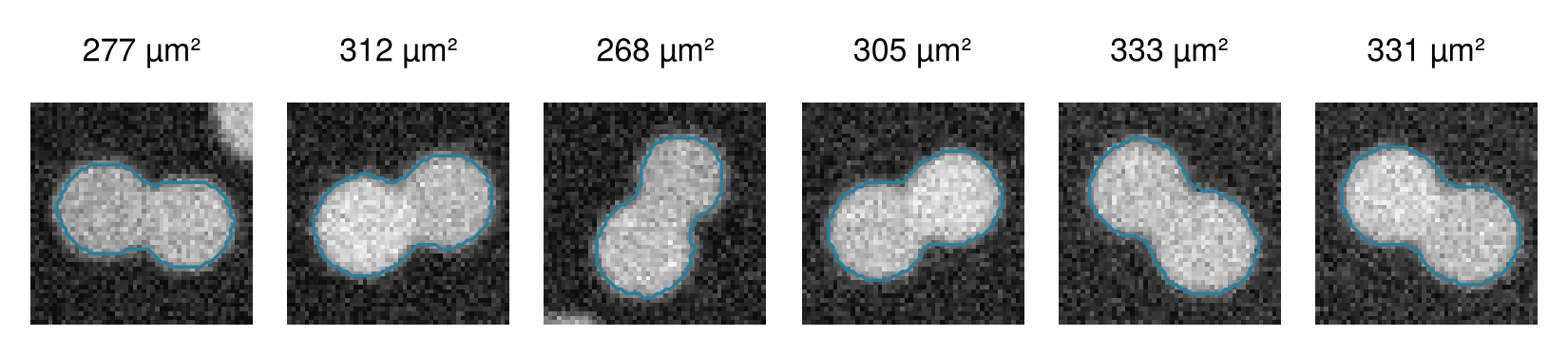 The six regions above 1.5 times the median area, cropped at one scale, each with its outline in blue and its area above it, from 268 to 333 µm². Every outline holds two touching cells.