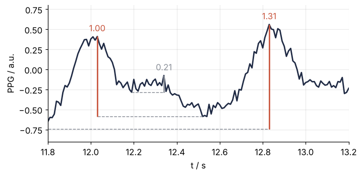 Zoom on 11.8 to 13.2 s of the pulse signal, in arbitrary units. Vertical bars run from each peak down to its base, a dashed line from the base trough: the two beats stand 1.00 and 1.31 above their bases, the dicrotic wave between them only 0.21 above the notch before it.