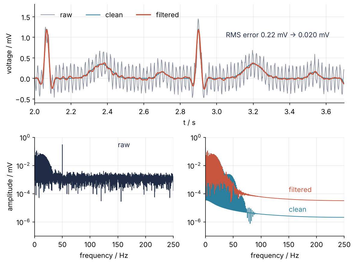 Top: two heartbeats of a synthetic ECG, raw with hum and noise, filtered, and clean; the filtered trace lies on the clean one. Bottom: amplitude spectra before and after filtering on a logarithmic axis; after filtering the 50 Hz line is gone and the spectrum falls away above 40 Hz.