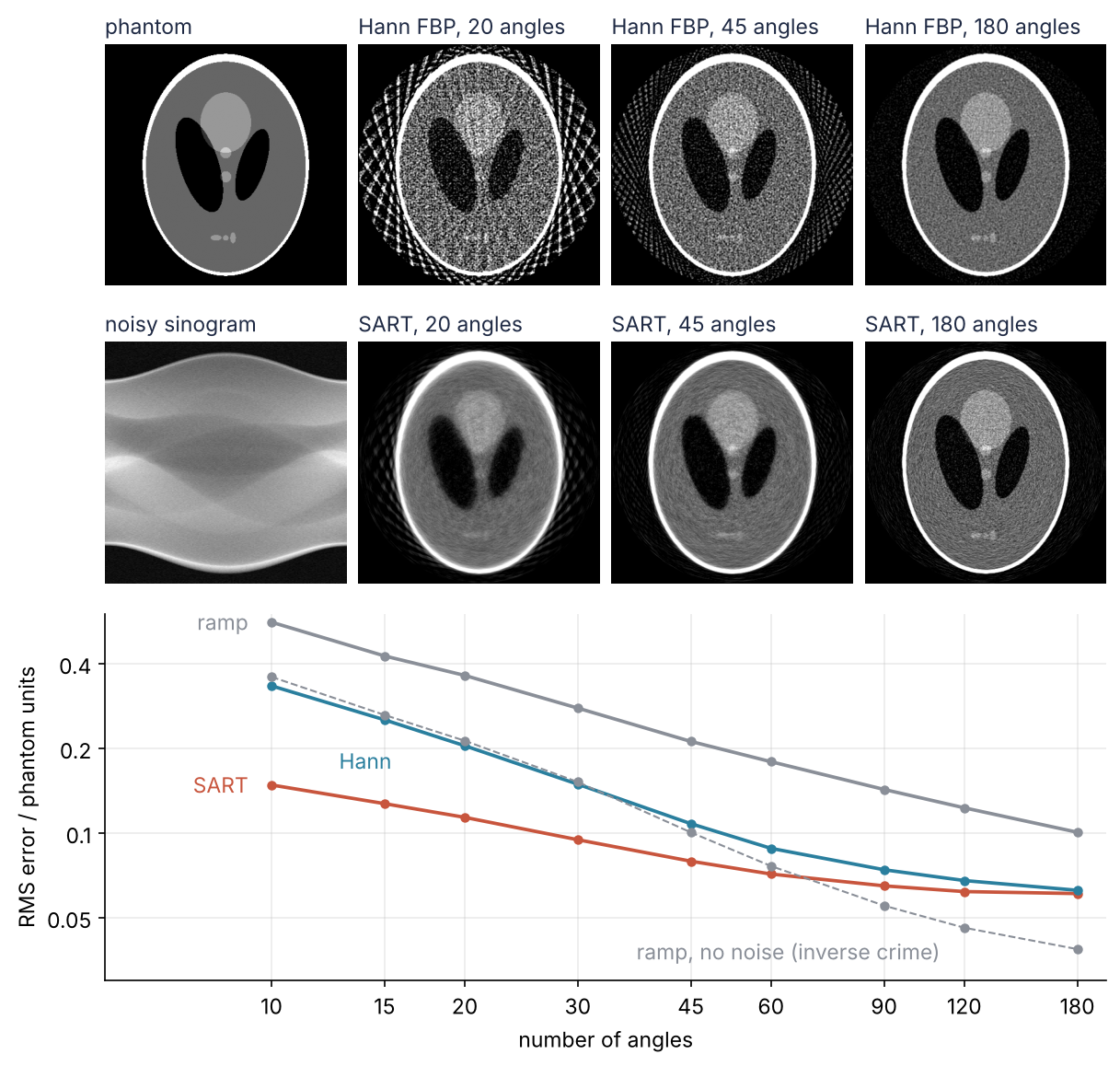 Top: the head phantom and its noisy sinogram, then reconstructions from 20, 45, and 180 noisy angles, filtered back projection with a Hann filter above, two SART passes below. Bottom: RMS error against number of angles, log-log; SART leads at few angles and Hann catches up near 180.
