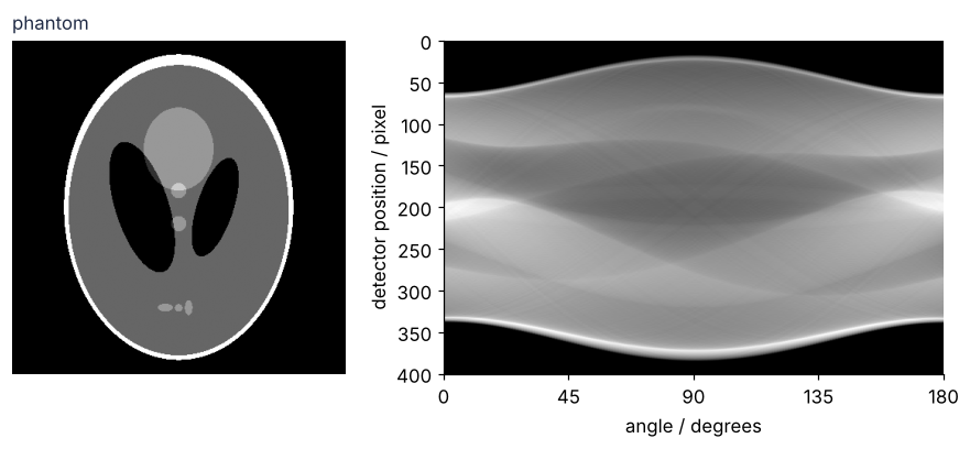 Left: the Shepp-Logan head phantom in gray, skull saturated white, brain ellipses visible. Right: its sinogram, detector position in pixels against angle in degrees from 0 to 180; the skull traces a bright band and the small ellipses trace faint sine curves.